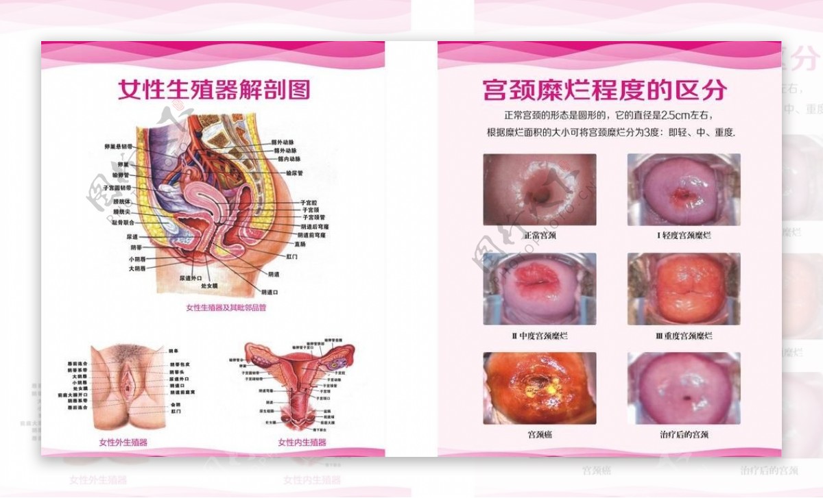 宫颈图女性解剖图图片