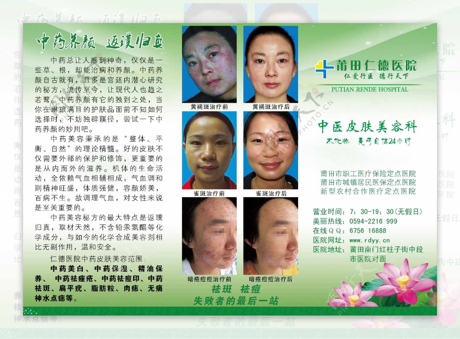 中医皮肤美容宣传单b面图片