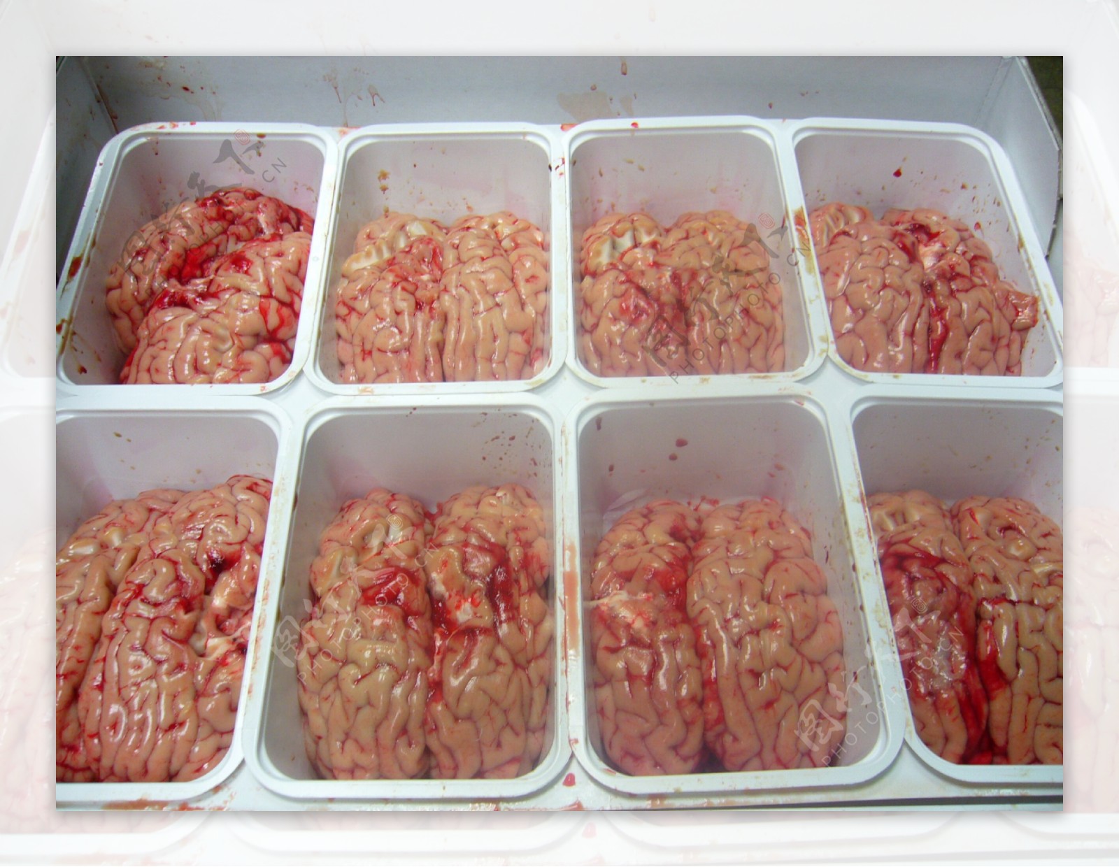 人类大脑图片