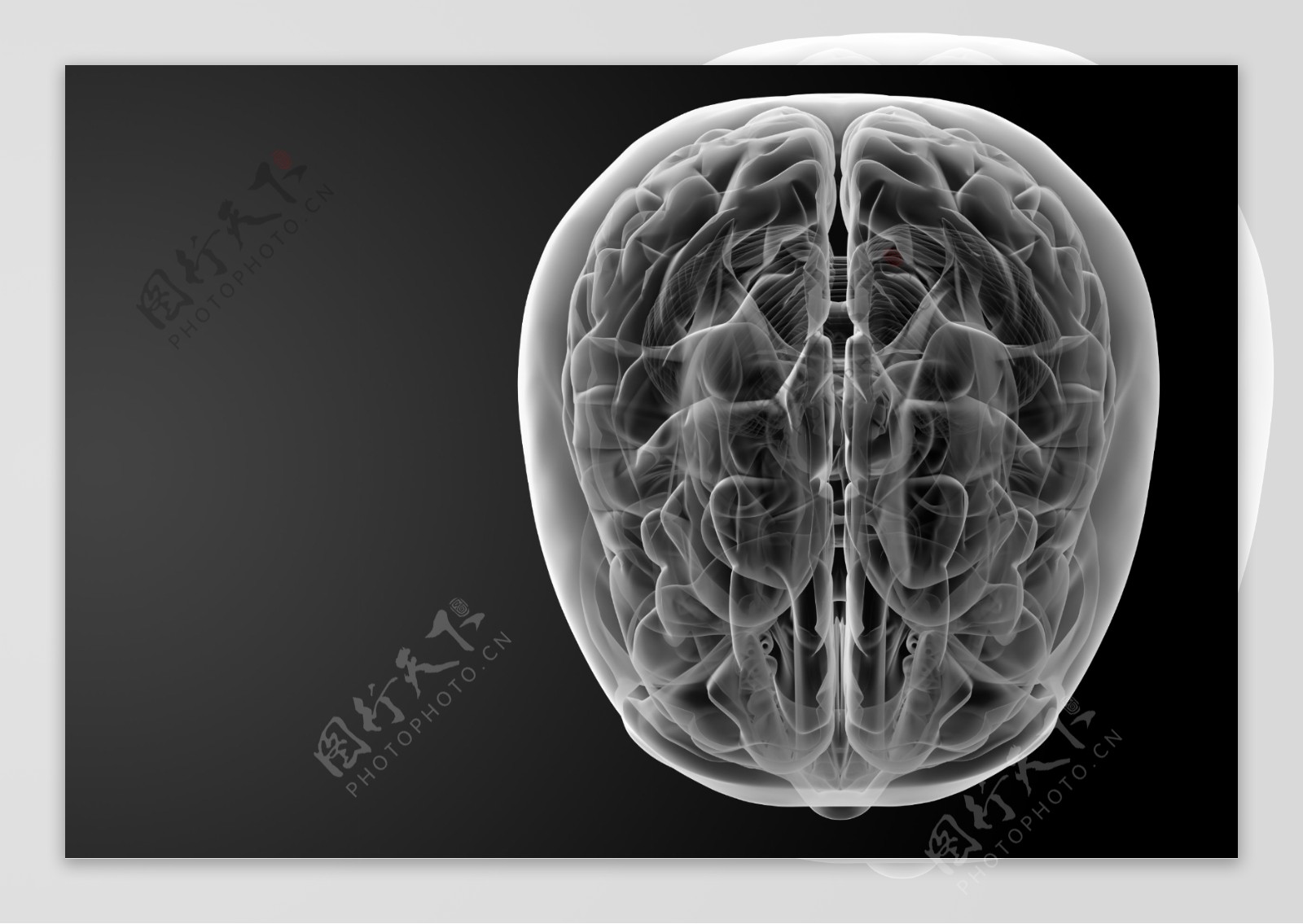 大脑结构图片