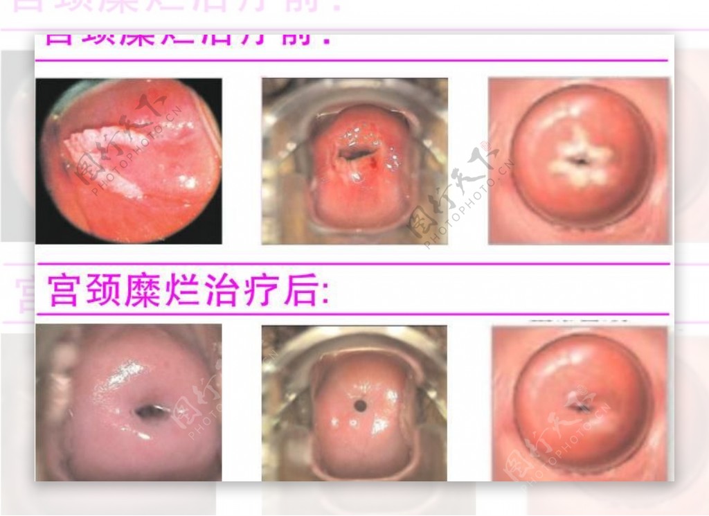宫颈图图片