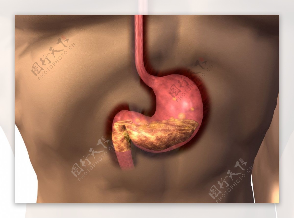 胃消化系统图片