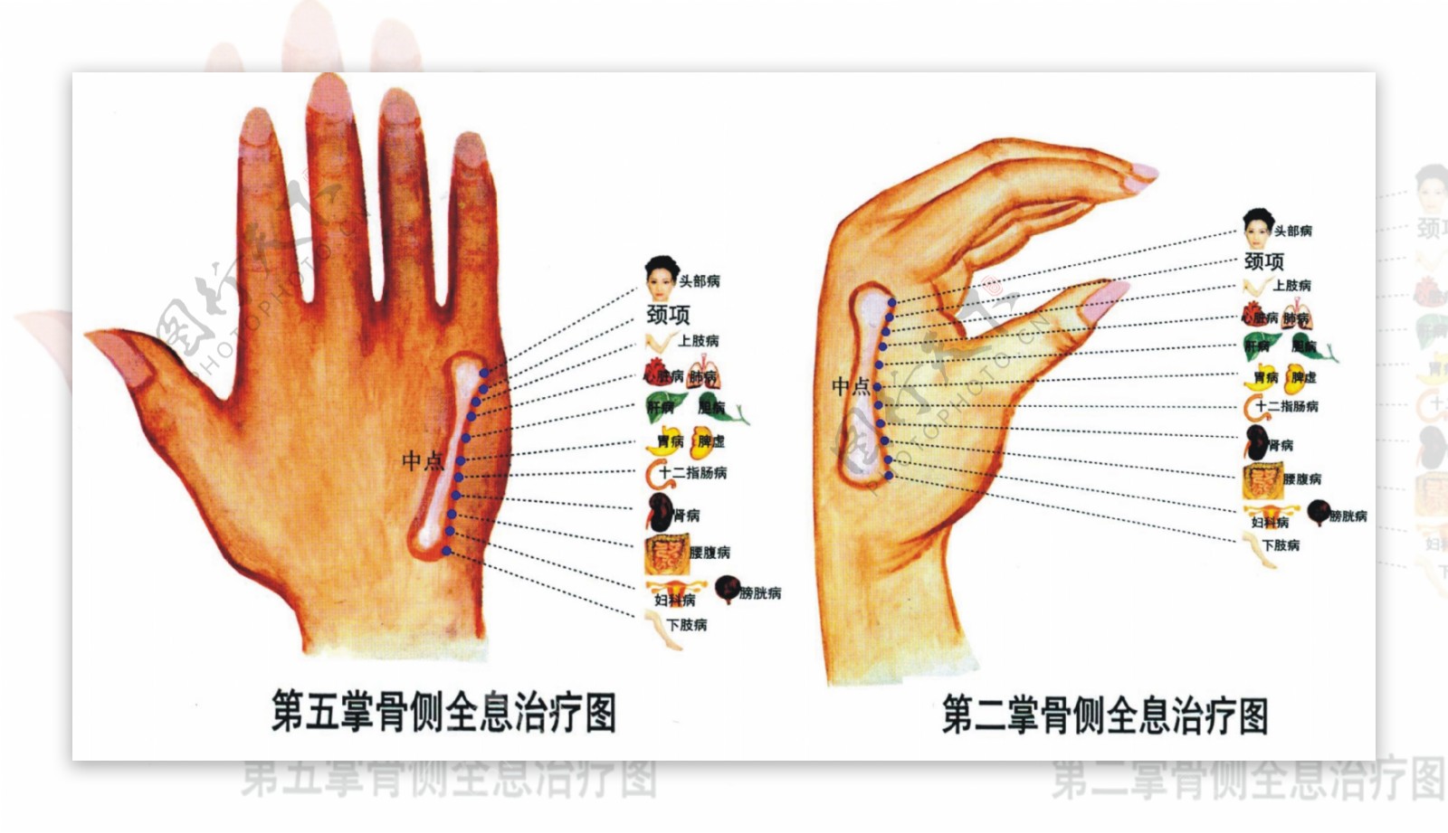 手掌反射区全息治疗图图片