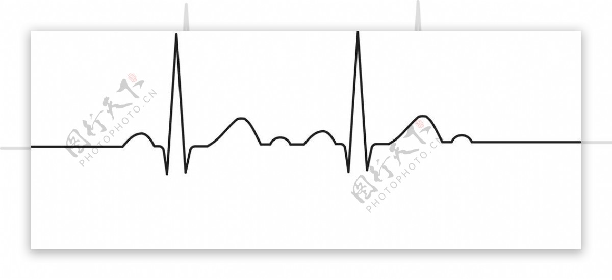 心电波形图图片