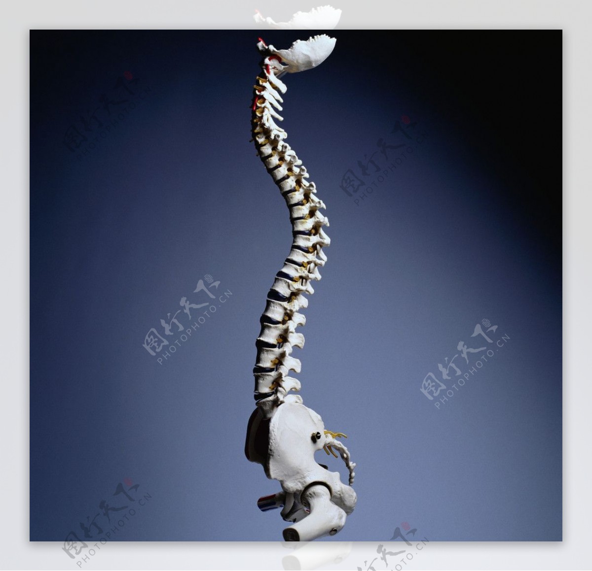 弯曲脊髓图片