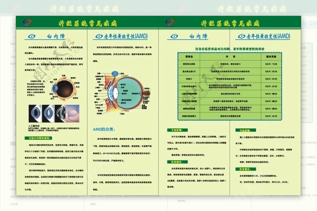 白内障图片