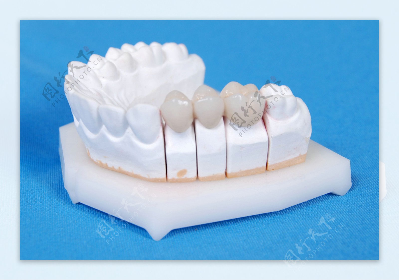 金属牙医工具与义齿假牙紧靠在牙医诊所蓝色基调的牙医椅子牙齿美白图片下载 - 觅知网