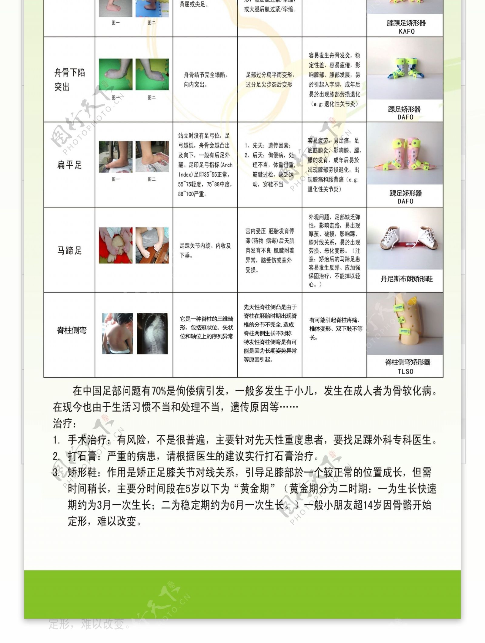 常见儿童足膝部及脊柱问题展架