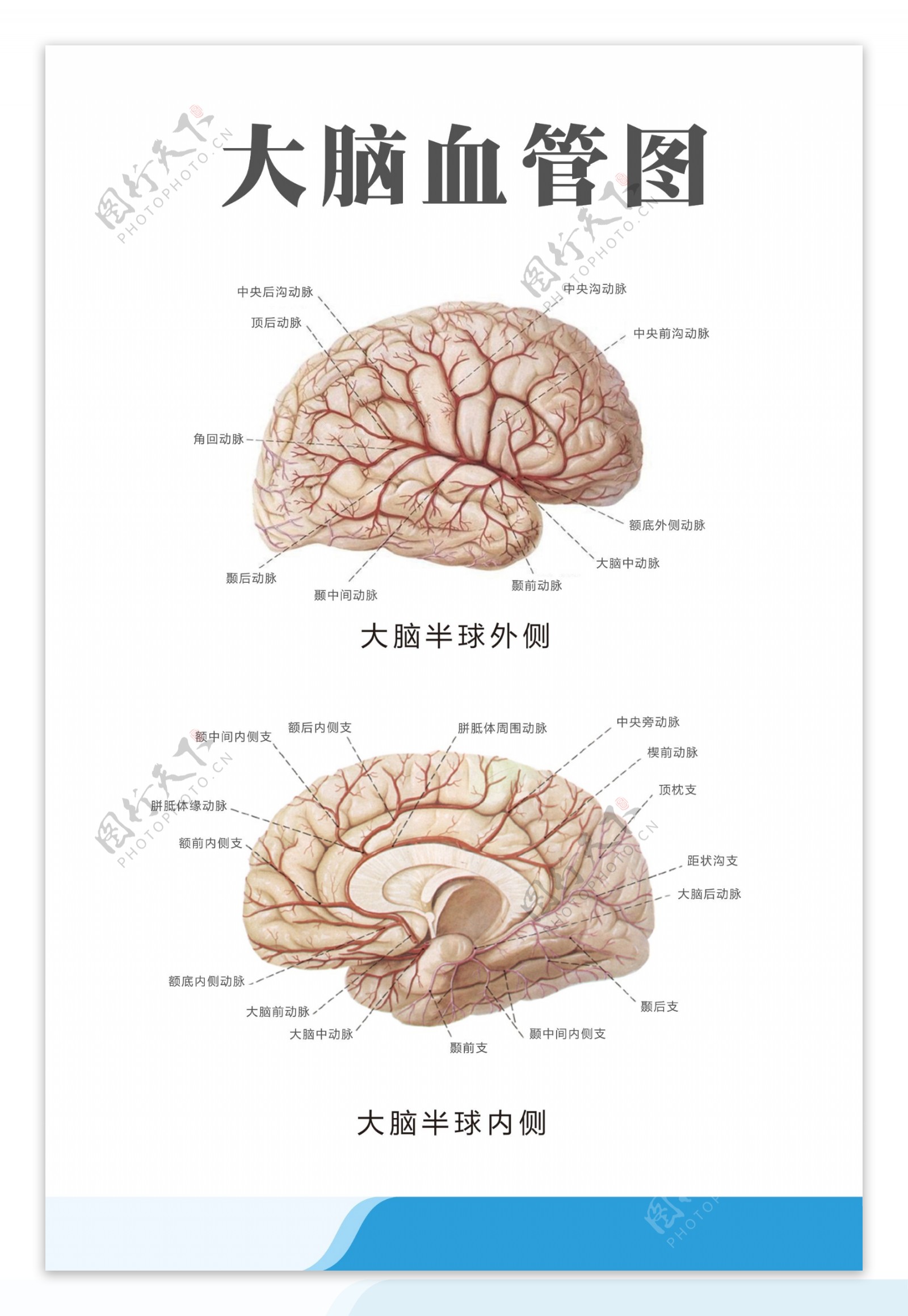 医疗人体科室挂图大脑血管图