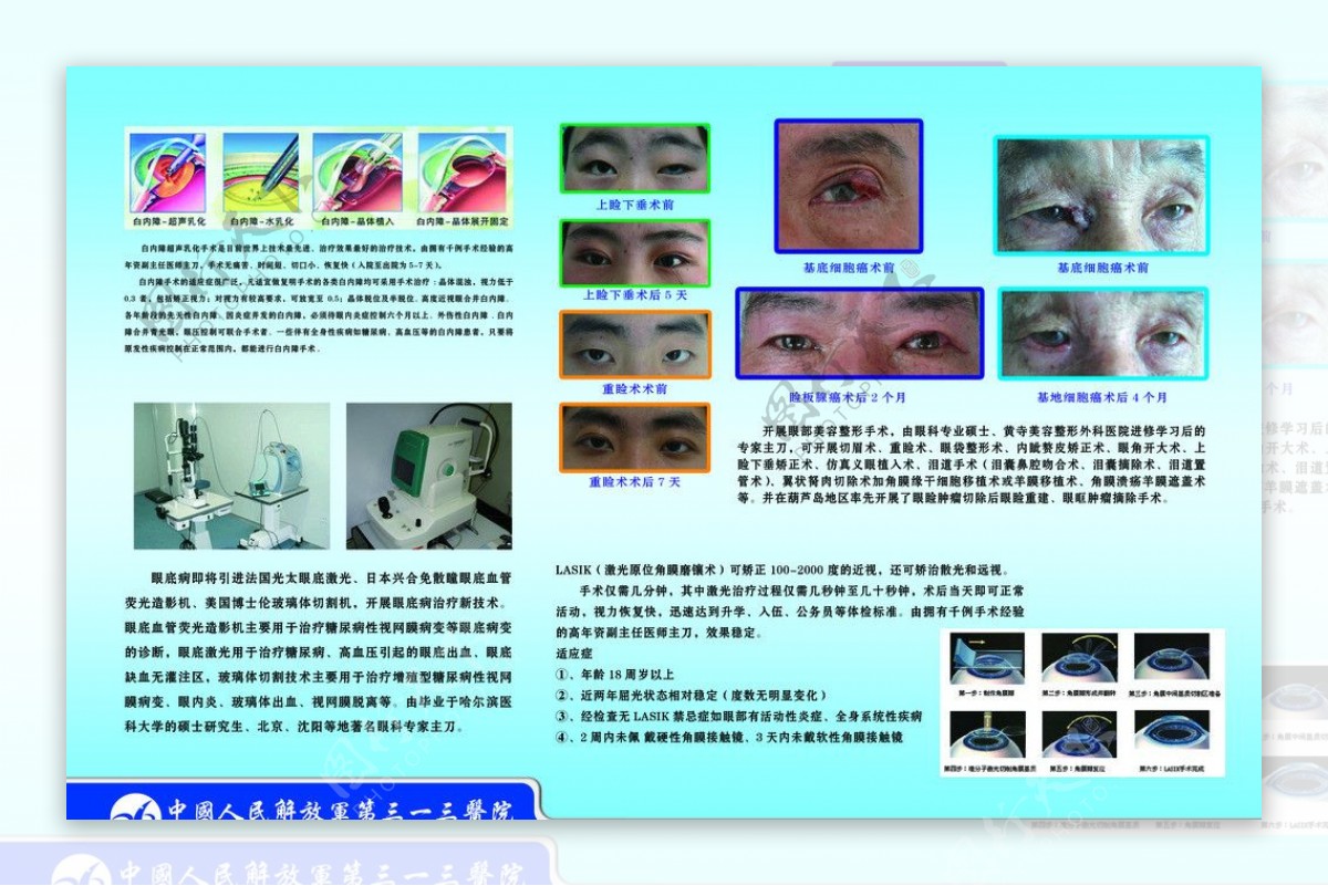 医院眼科图版