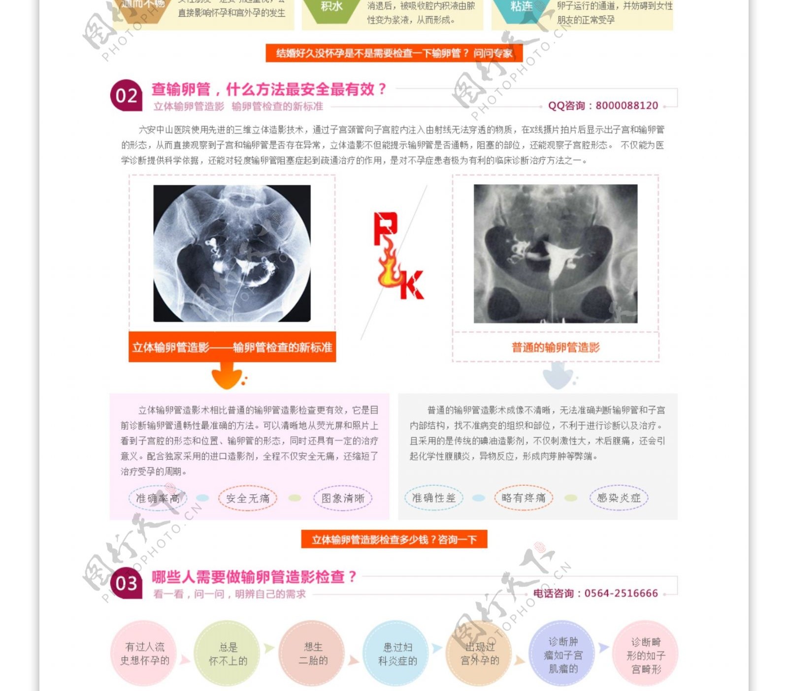 输卵管造影pc